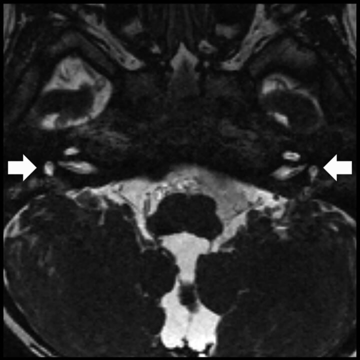 Fig 2.