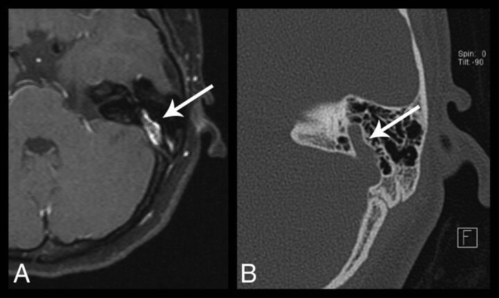 Fig 10.