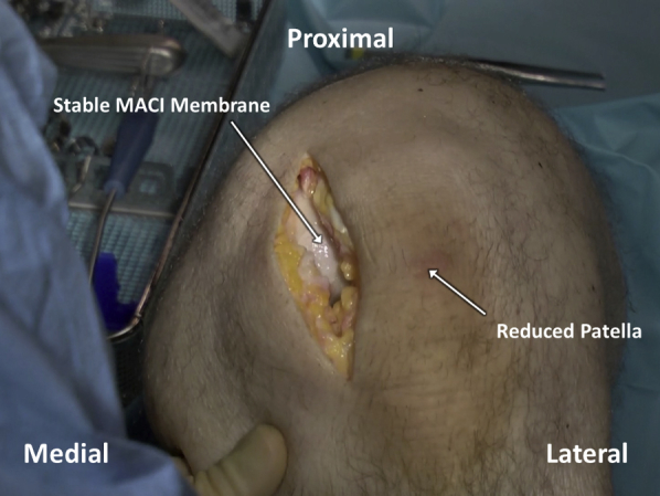 Fig 14