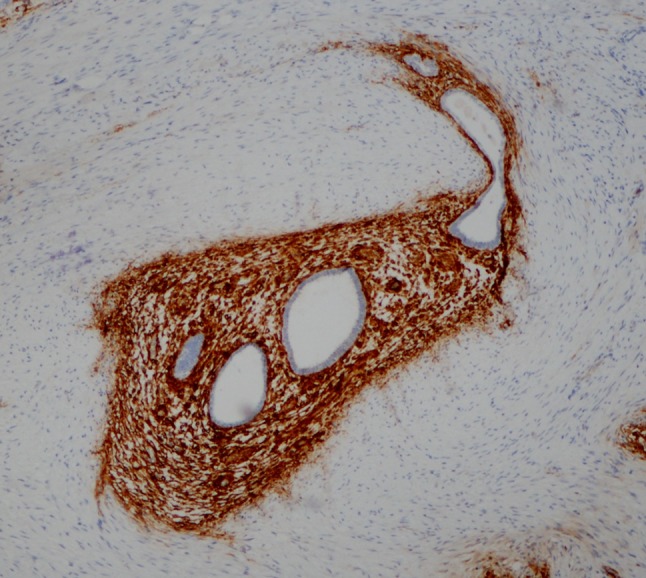 Fig. 2