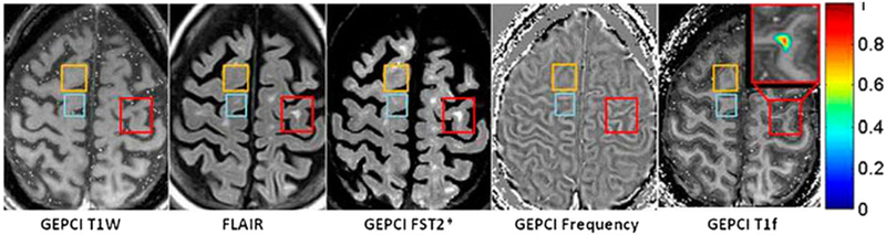 Figure 11.