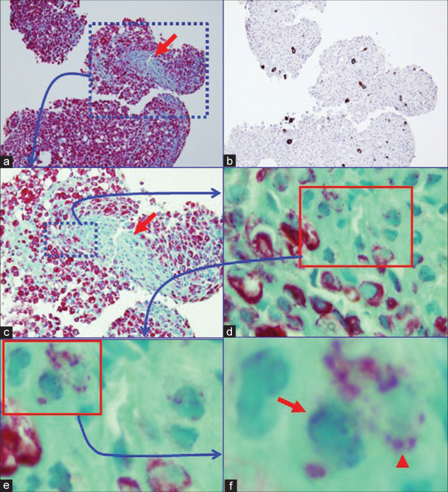 Figure 11: