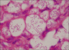 Figure 3a