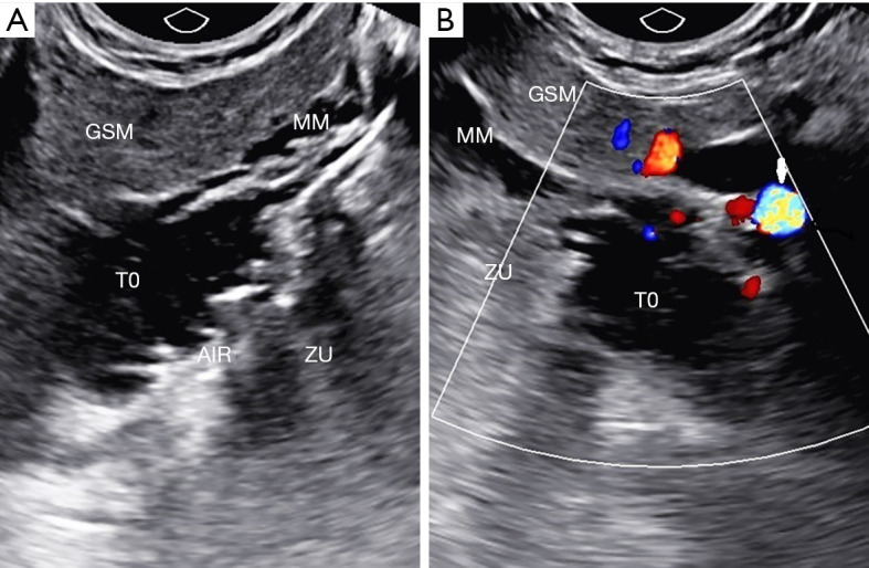 Figure 9