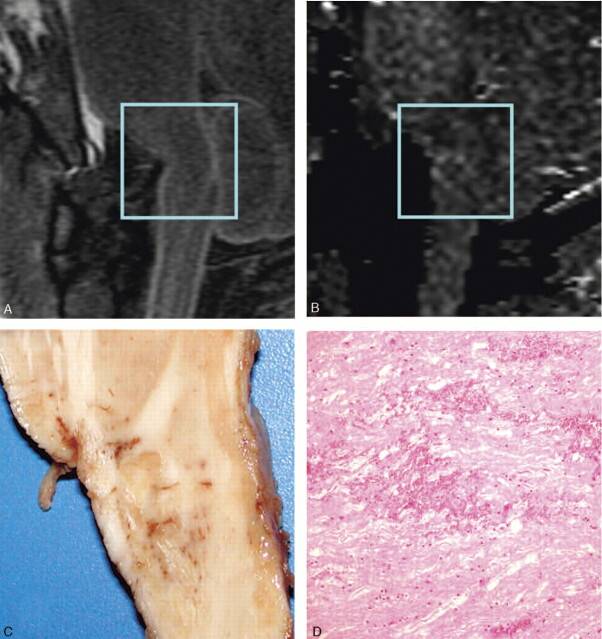 Fig 2.