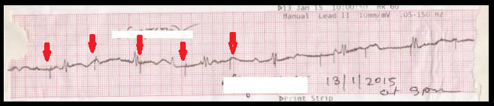Fig. 2