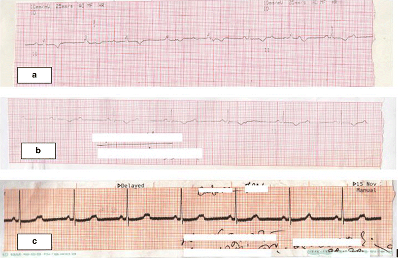 Fig. 1