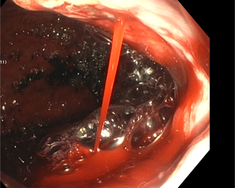 Figure 4