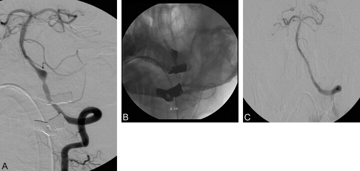 Fig 1.