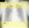 Fig. 12.
