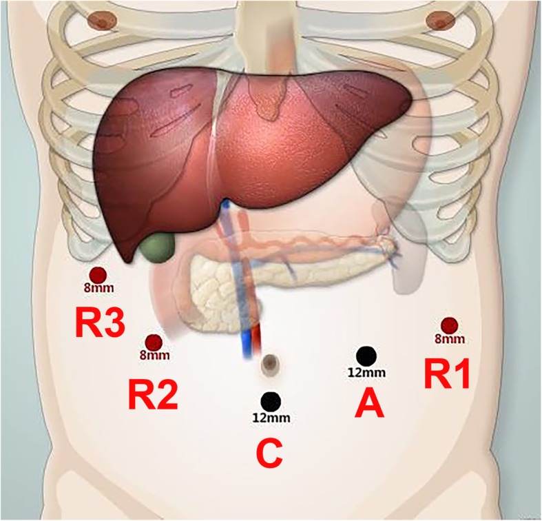 Fig. 2