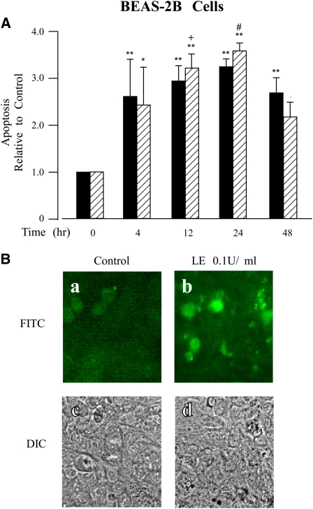 Leukocyte Elastase Induces Lung Epithelial Apoptosis Via A Par Nf B And P Dependent