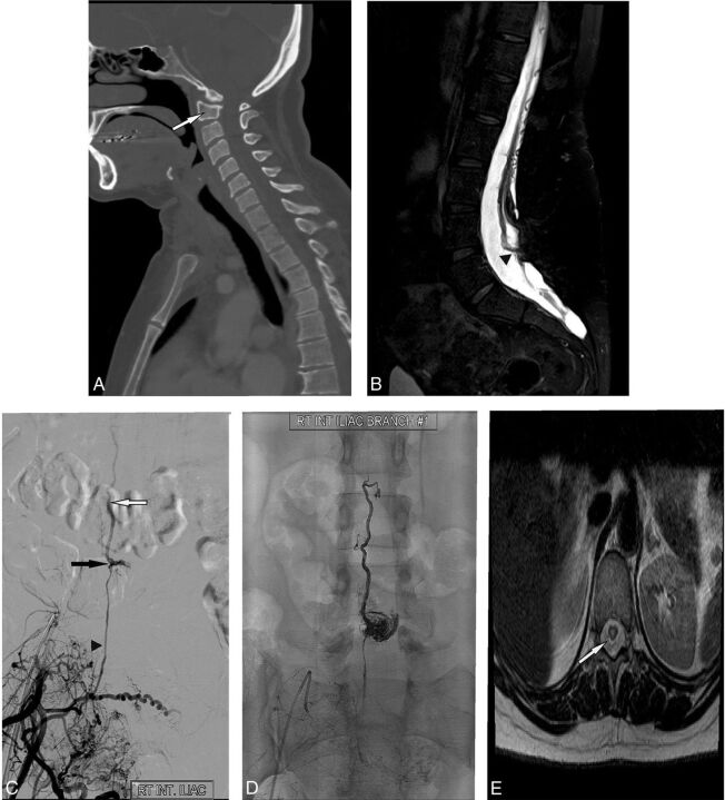 Fig 2.