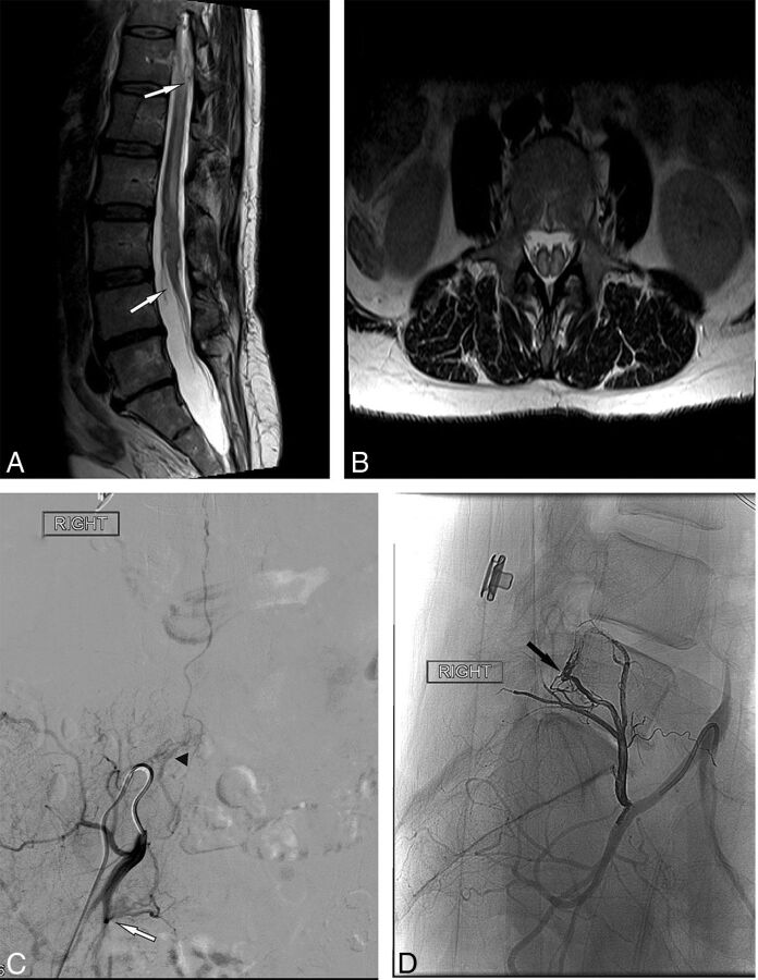 Fig 3.