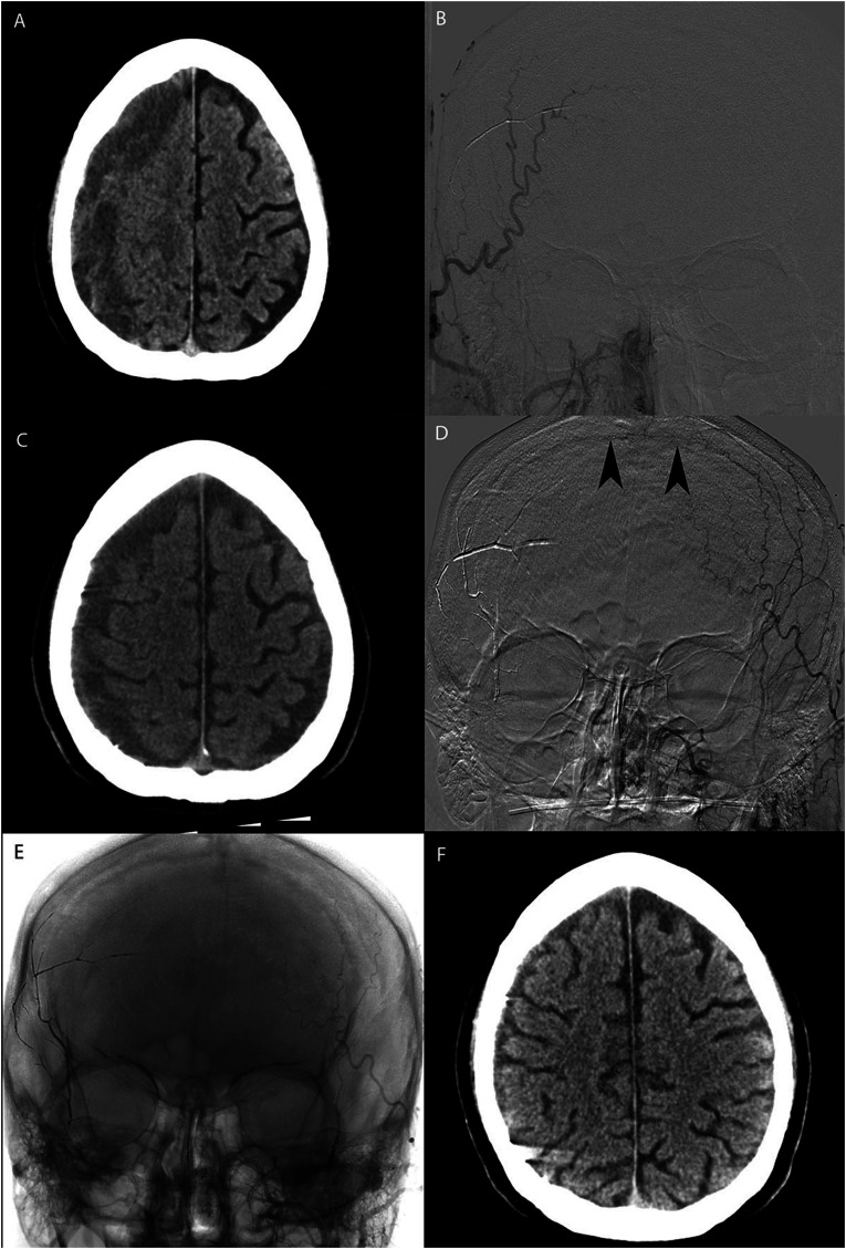 Figure 1.