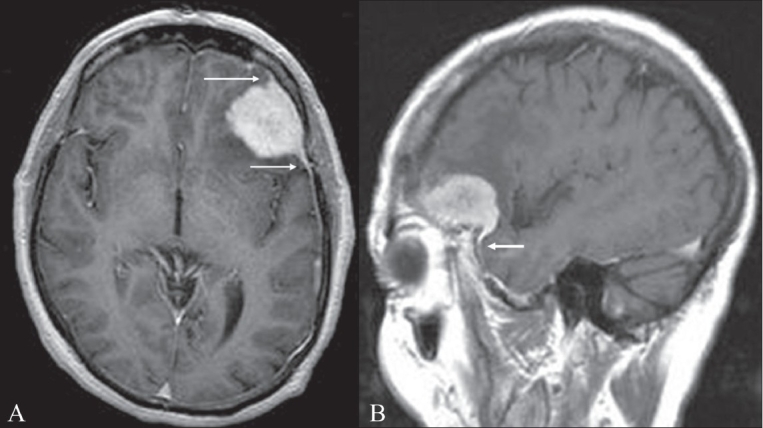 Figure 3 (A–B)