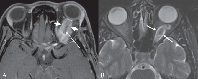 Figure 10 (A, B)