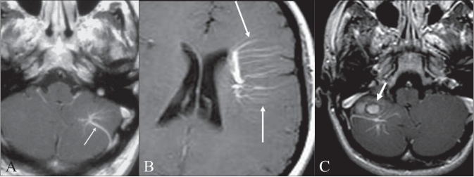 Figure 4 (A–C)