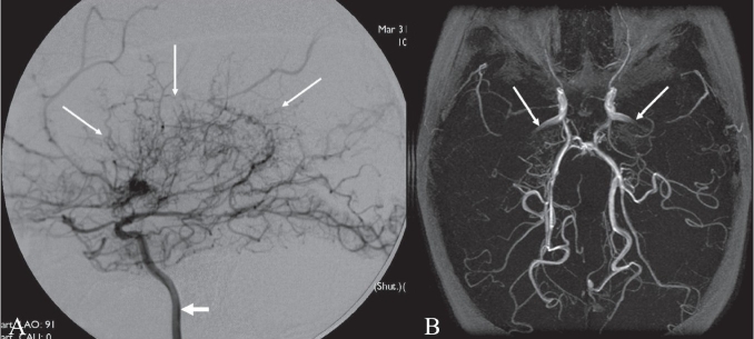 Figure 12 (A, B)