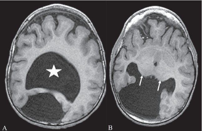 Figure 6 (A, B)