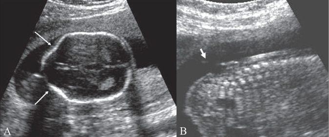 Figure 5 (A, B)