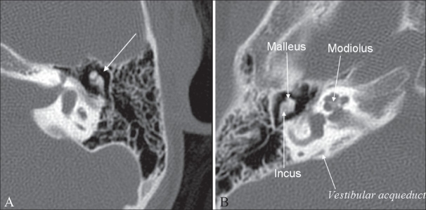 Figure 1 (A, B)