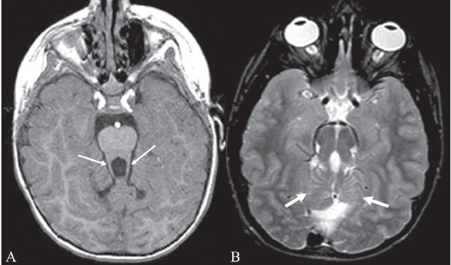 Figure 15 (A, B)