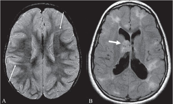 Figure 18 (A, B)