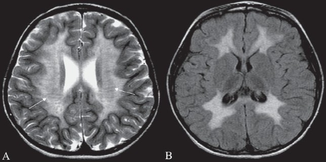 Figure 16 (A, B)