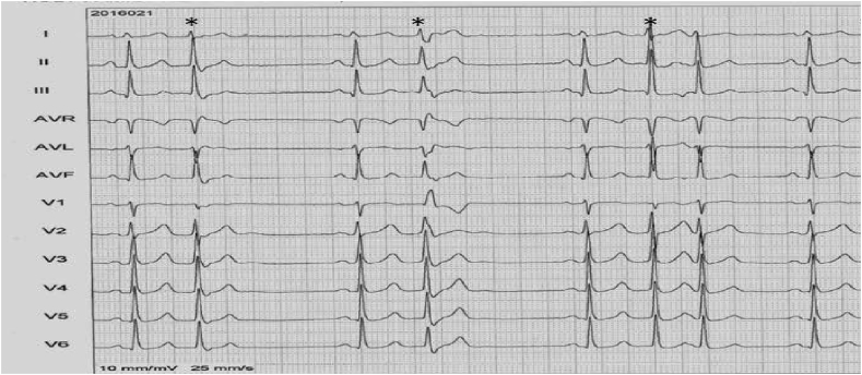 Fig. 2