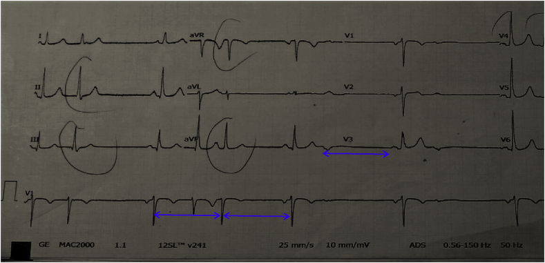 Fig. 1