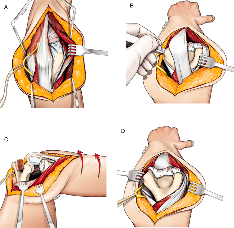 Fig. 7