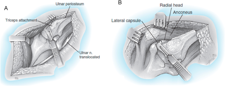 Fig. 5