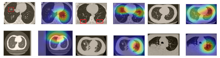 Figure 18