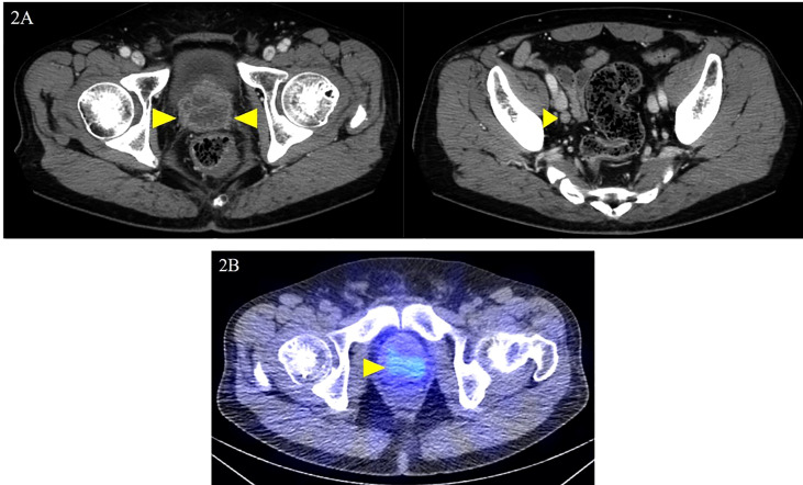 Figure 2