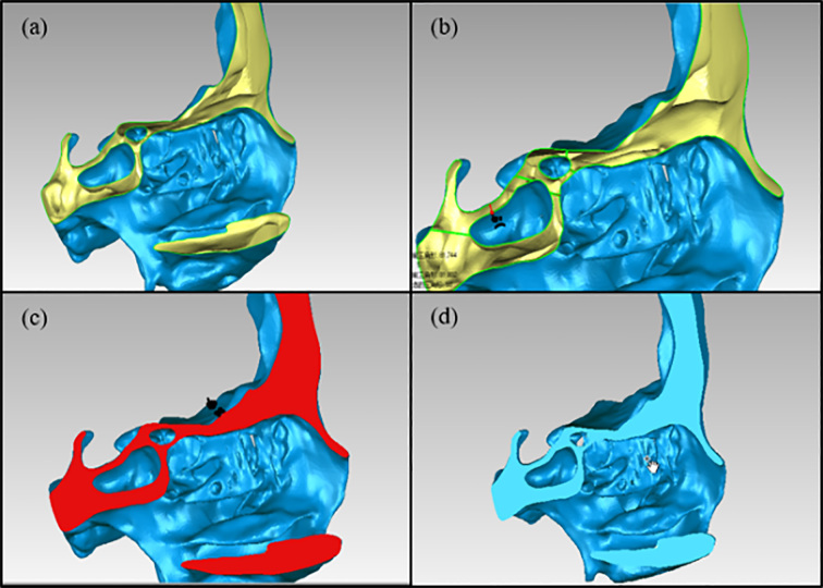 Figure 14.