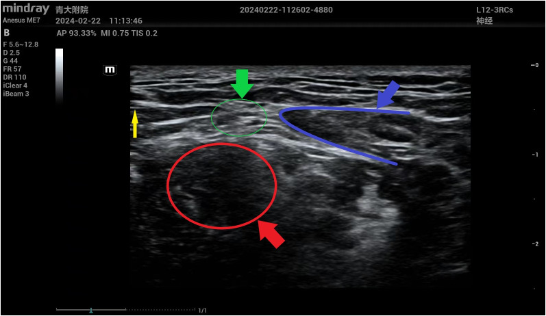 Figure 2