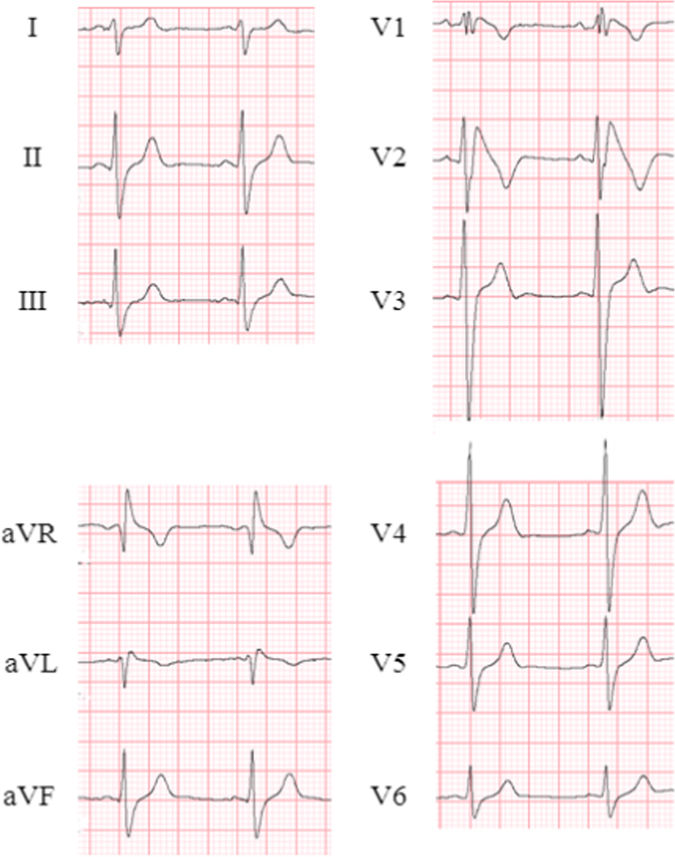 Fig. 4