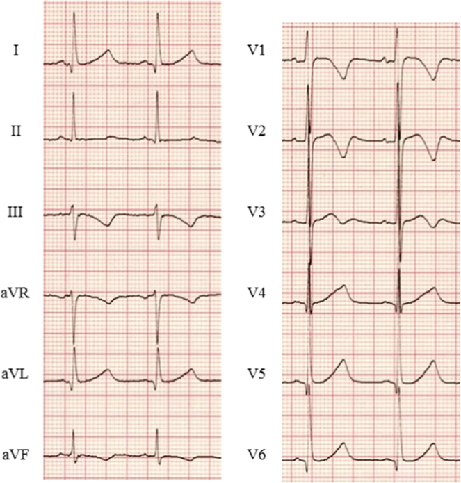 Fig. 2