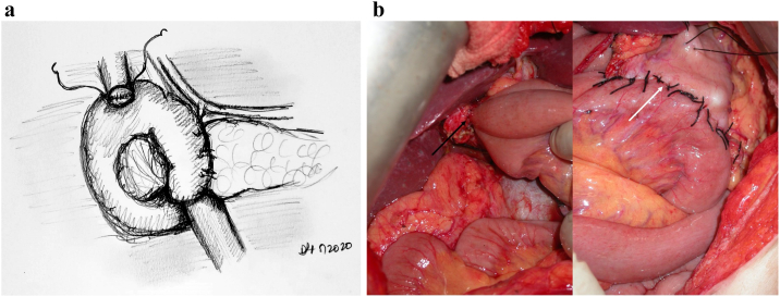 Fig 8