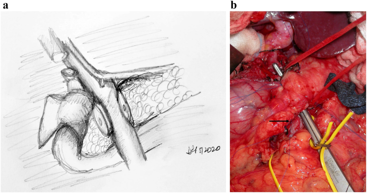 Fig 5