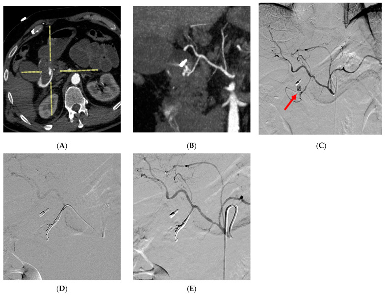 Figure 4