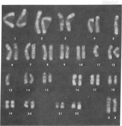 graphic file with name pnas00066-0175-a.jpg