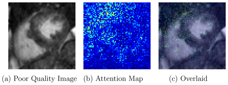 Fig. 11