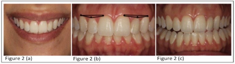 Fig. (2)