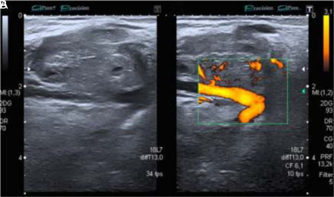 Figure 10. A, B.