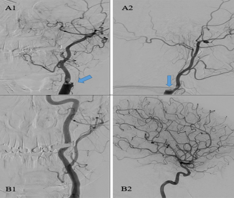 Fig. 4