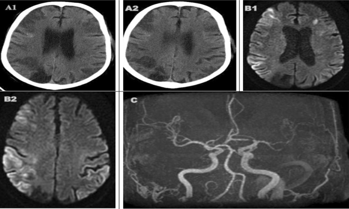 Fig. 3