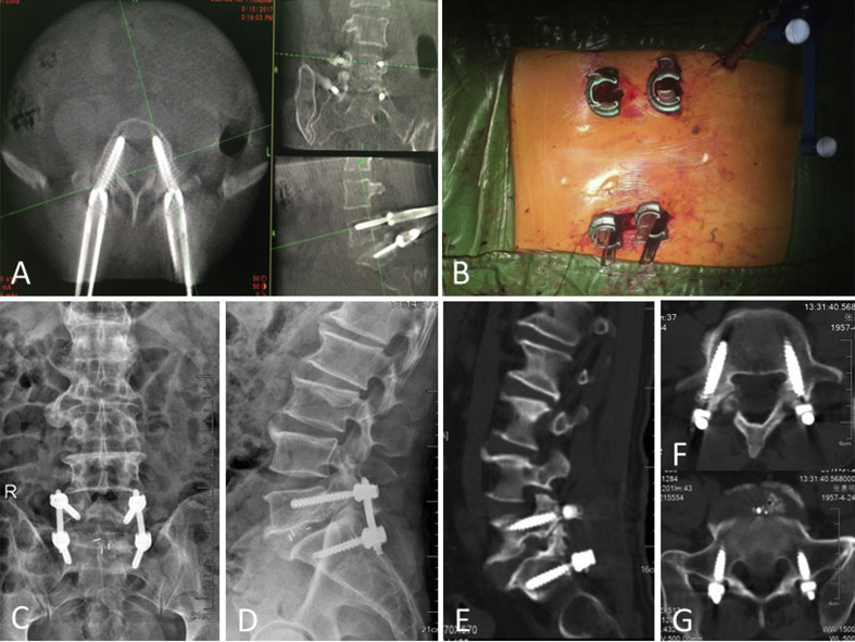 Figure 3