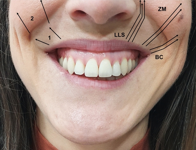 Fig. 2